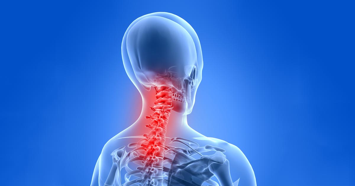 Tucson car accident and neck pain treatment